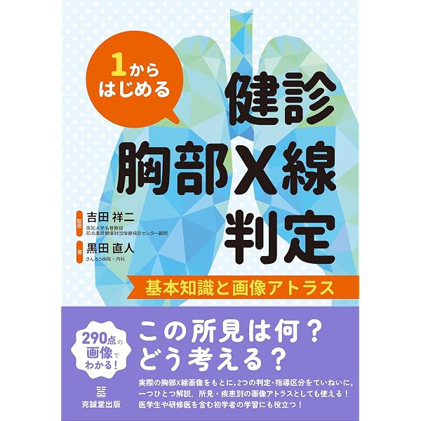 肺がん検診のための胸部X線読影テキスト | 日本肺癌学会集団検診委員会